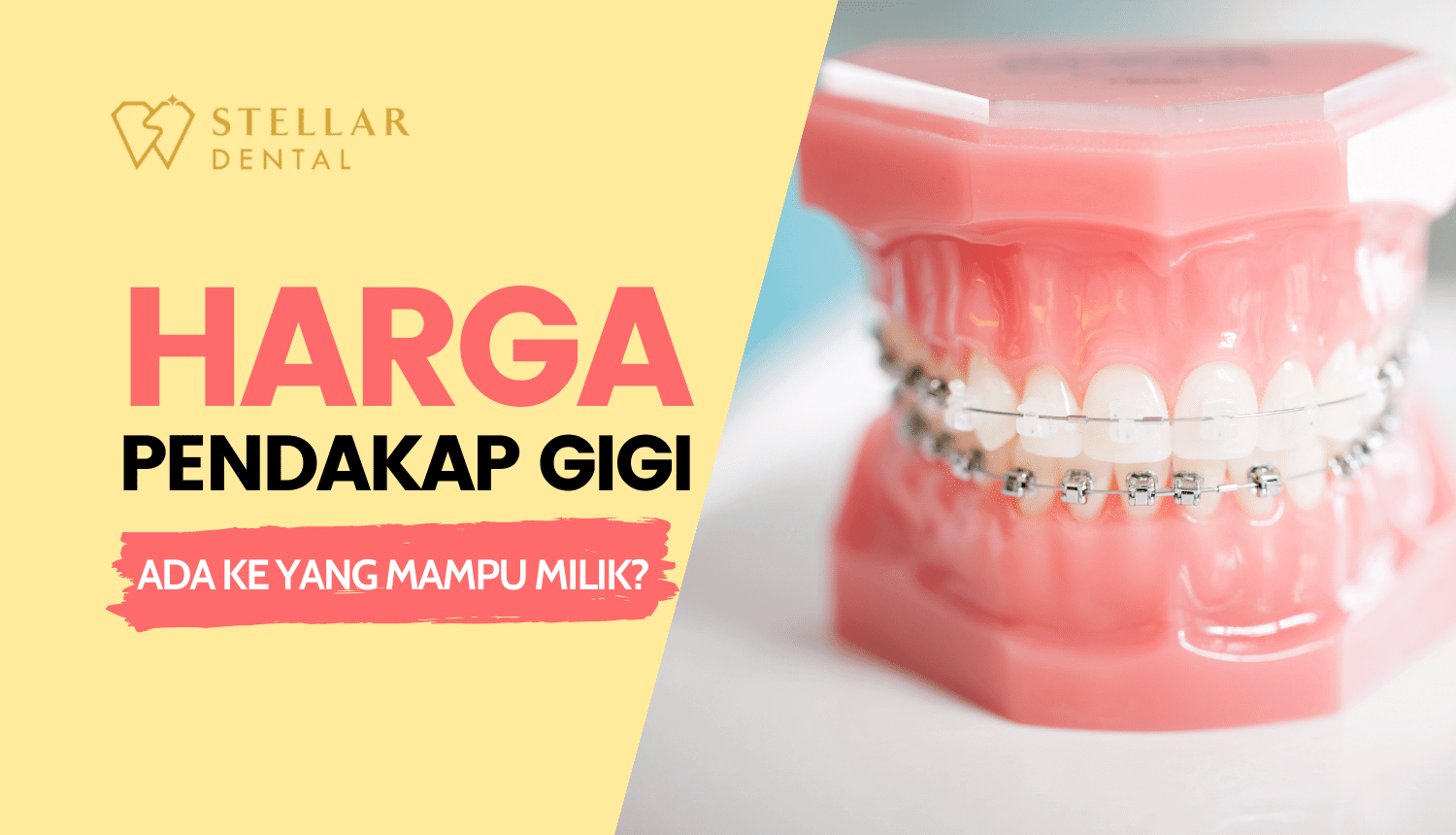Harga Pendakap Gigi